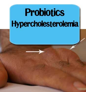 probiotics-Hypercholesterolemia