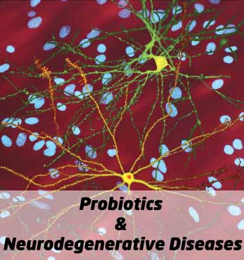 Neurodegenerative-Diseases